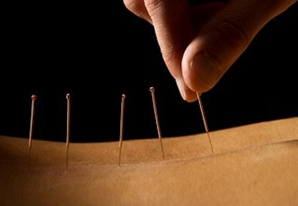 Calgary Acupuncture | Essence Wellness Clinic - Essence Wellness Clinic  Calgary Marda Loop